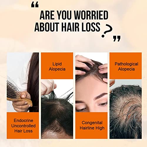 Savvy-High-Hair-Growth-Purc-Oil-for-Hair-Growth-HOVO-Hair-Density-Essential-Oil-Natural-Hair-Regrowth-Serum-Anti-frizz-Hair-Serum-Reduce-Dry-Hair-Care-Essential-Oil-for-Women-Men-5-pcs
