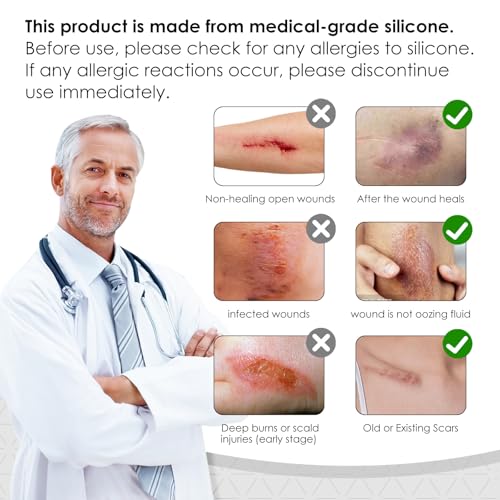 silicone scar sheetssilicone scar tape for removal treatmentmedical grade scar tape for surgical scarswhite1234 x 4234 roll - 107m