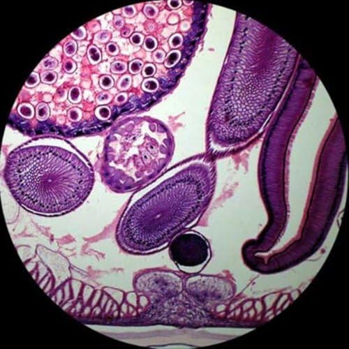 Image of AmScope T360B-5M Digital Trinocular Compound Microscope, 40X-2000X Magnification, WF10x and WF20x Eyepieces, Brightfield, LED Illumination, Abbe Condenser, Double-Layer Mechanical Stage, Includes 5MP Camera with Reduction Lens and Software