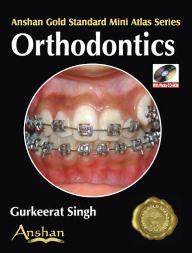 Mini Atlas Of Orthodontics : Amazon.in: Books