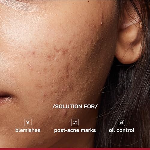 Image of /PHD / 10% Niacinamide Spot Correcting Serum | Niacinamide for Oily Skin, Acne Scars & Enlarged Pores | Face Serum for Acne-Prone Skin with 2% NAG | Fades Marks, Controls Oil I 10ml