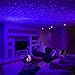 BlissLights Sky Lite - LED Laser Star Projector, Galaxy Projector, Nebula Light (Blue Stars, Blue Cloud)