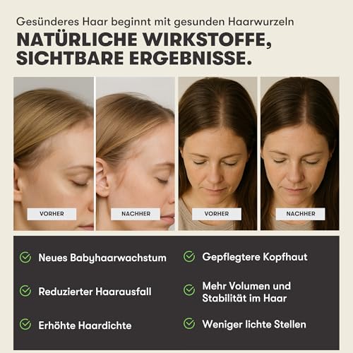 O.C. HAIRCARE Serum na porost włosów na noc - Serum do włosów przeciw wypadaniu | z rozmarynem, pantenolem i aloesem | Wspomaga porost włosów i zdrową skórę głowy | 100 ml