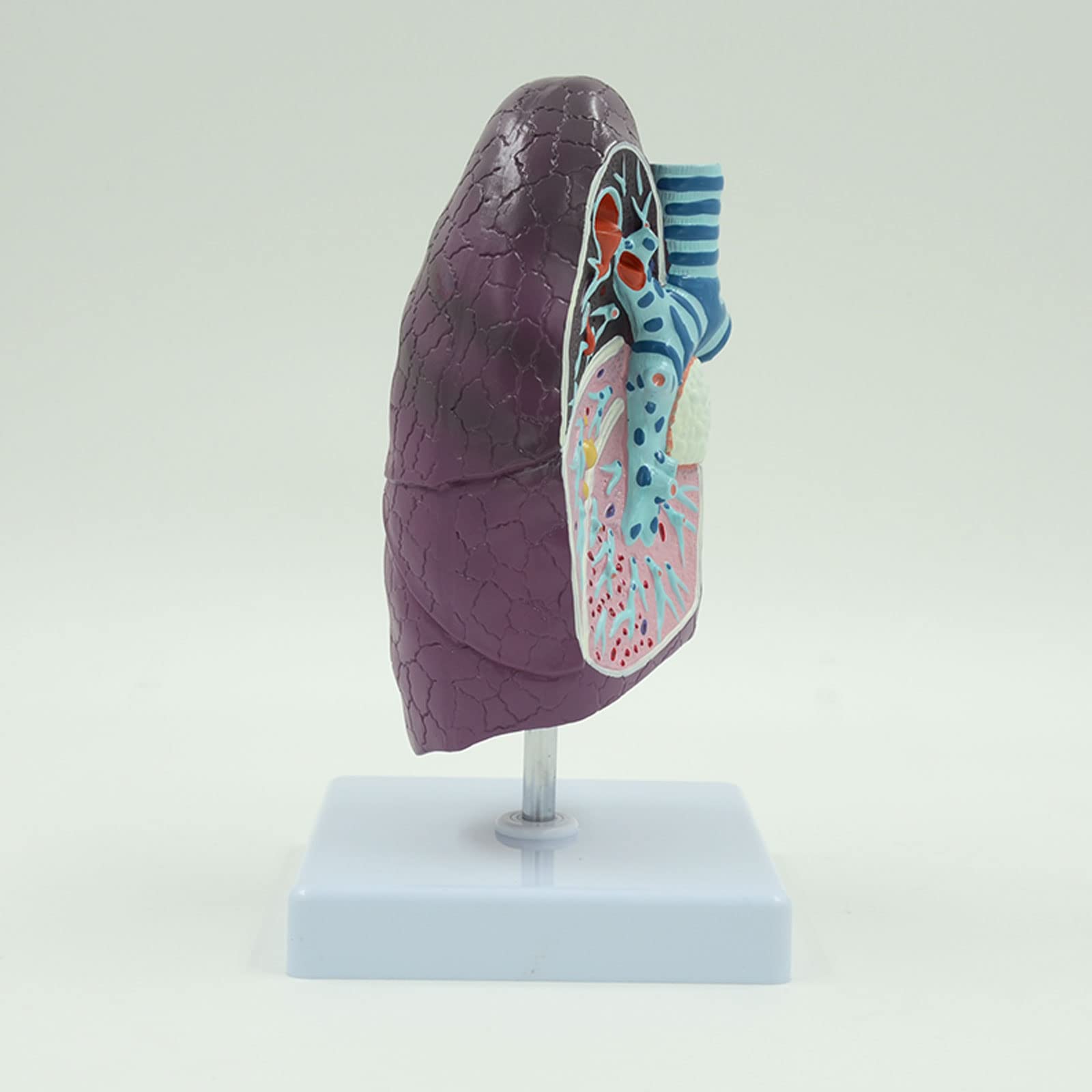 Modelo De Pulmón Humano, Estructura De Pulmón Humano Enfermo Modelo De Sistema Respiratorio para Estudios Anatómicos Pantalla Ensatomía Anatomía Suministro Y Equipo Médico