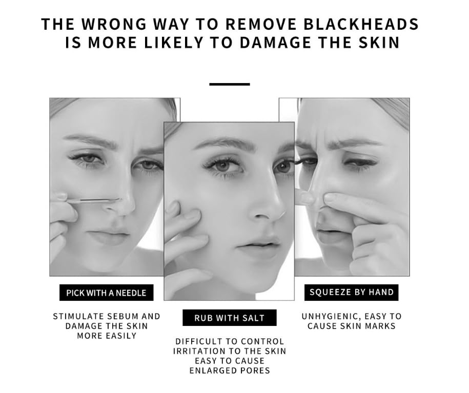 Miniatura 5 de Parche de nariz para eliminar puntos negros (10 piezas), limpia profundamente los poros, puntos negros, adecuado tanto para hombres como para