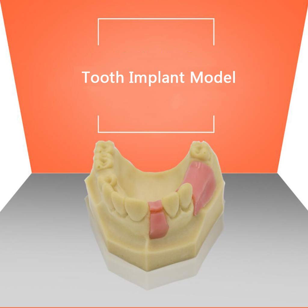 Zęby Model Denture Repair Sadzenie Szkolenia Żywicy Materiał Medyczny Pomoc Szkoleniowa Medyczna