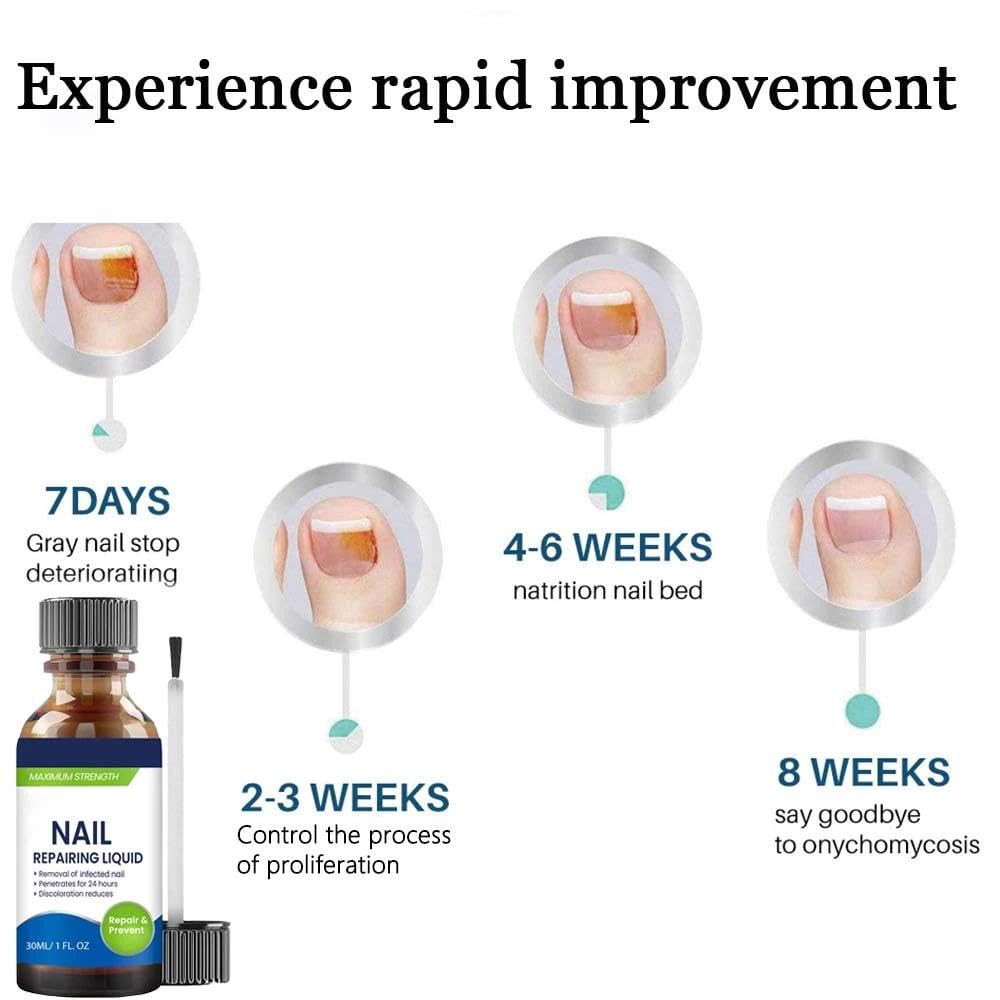 A Speedy and Effective Approach to Toenail Issues - Combating Thick, Discolored Nails - Powerful Solution for Addressing Yellow and Brown Nails - Image 4