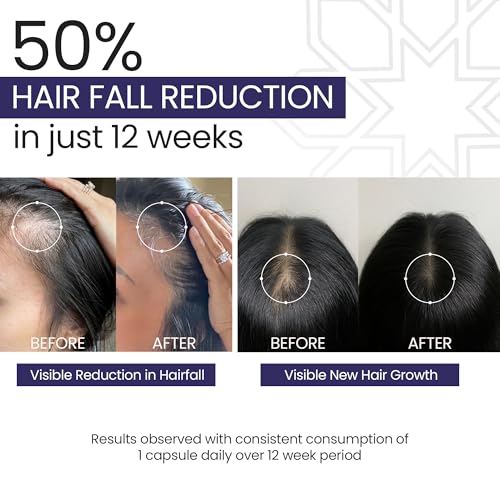 Image of Nutri Supplement for Hair Growth, Nutraceutical for Hair Fall, For Stronger Hair, With Green Tea & Grape Seed Extracts, Multivitamins, Science-backed, Dermatologist-tested, 30 Tablets