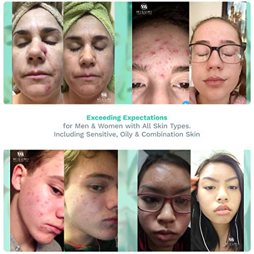 image for MISUMI Purifying Toner for Face & Skin – Pore Minimizer Facial Astri