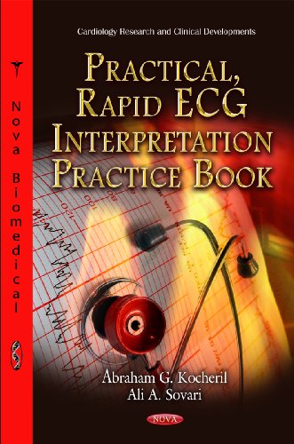  Practical, Rapid ECG Interpretation Practice Book