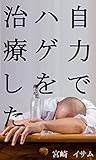 ハゲを治した体験談。AGA治療に育毛剤と病院は要らない。