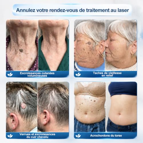Vignette produit
