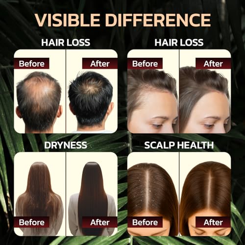 Zenolio Labs Batana Oil for Hair – 4.2oz Pure Botanical Scalp Oil — view 4