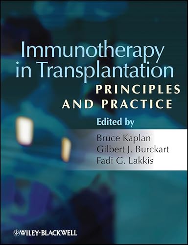 Immunotherapy in Transplantation: Principles and Practice