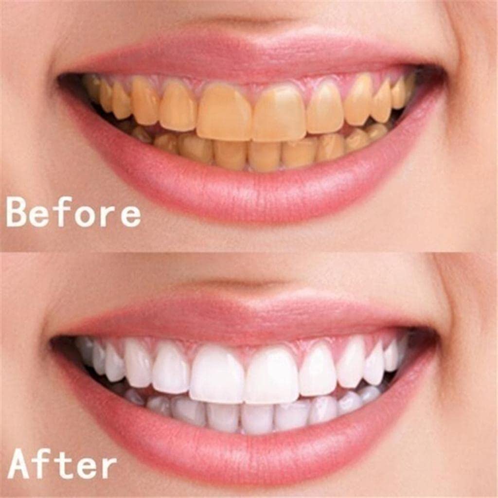 ATORSE 2 Pcs 10Ml Teeth Whitening Water Oral Hygiene Care Tooth Cleaning Liquid|Health & Beauty|Health Care|Other Health Care Supplies 4