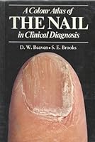 Color Atlas of Nails (Wolfe Medical Atlases) 0723415323 Book Cover