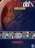 Abdomen (Expert Differential Diagnoses)