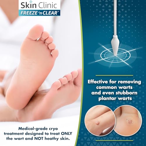 skin clinic freeze 39n clear advanced wart remover tough on warts gentle on skin 12 precision applicators
