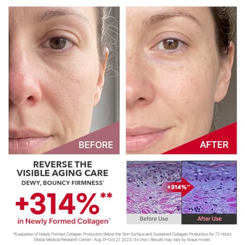 CENTELLIAN 24 Madeca Cream Time Reverse TECA Anti-Aging Moisturizer – Ansicht 3