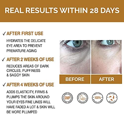  Anti Ageing Eye Serum/Eye Cream for Dark Circles, Puffiness & Crows Feet - Anti Wrinkle Eye Serum - Reduces Wrinkles, Bags, Saggy Skin & Puffy Eyes! Eye Cream. Q10 & Matrixyl 3000.