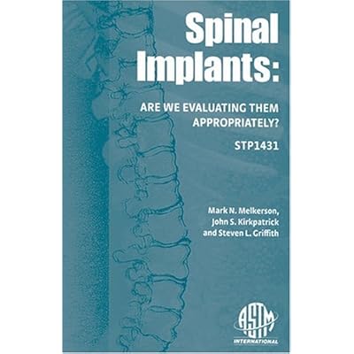 Spinal Implants