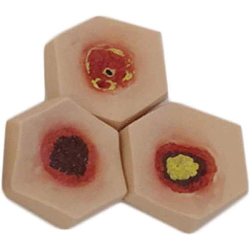 Modello di cura dell'ulcera da decubito - 4 fasi di piaghe da decubito simulatore di piaghe da decubito per formazione infermieristica e insegnamento - formazione medica decubito cura delle ferite