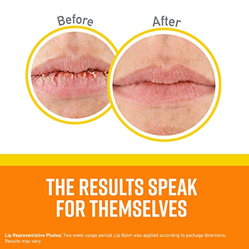 O'keeffe's Lip Repair Spf 35 Lip Balm, (Pack Of 2) #TOP3