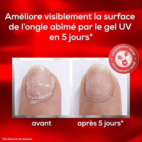 Essie - Soin des Ongles Réparateur - Répare les Ongles Abîmés par le Gel UV en 5 jours - Scelle, Protège et Épaissit l'Apparence des Ongles - Enrichi en Kératine et Céramides - To The Rescue – Image 4