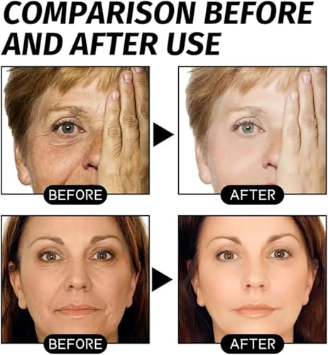 Image of Retinol Gold Face Mask for Glowing Skin - Snake Venom Peptide Peel Off Mask, Supports Hydration & Smooth Appearance, Deep Pore Cleansing Facial Mask for Men & Women 100ml (Peel-Off Face Mask)