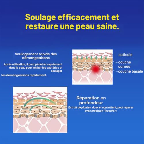Crème de protection contre l'eczéma - 20 g - Crème pour le corps - Réduit les démangeaisons et soulage les rougeurs et les irritations de la peau, apaise et nourrit la peau - Crème apaisante – vue 4