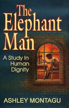 The Elephant Man : A Study in Human Dignity