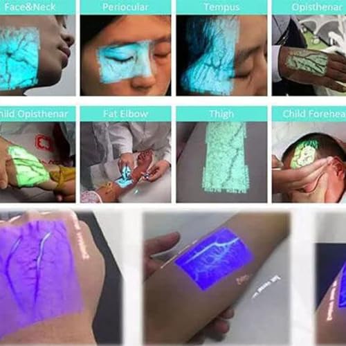 Rilevatore portatile per vene, con illuminazione a infrarossi per una visualizzazione accurata delle vene, strumento essenziale per infermieri e professionisti medici