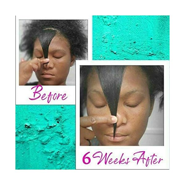 Hair Regrowth Serum ,Hair Growth Oil, Hair Serum, Anti Hair Loss, Thinning, Balding, Repairs Hair Follicles, Hair Salon - Hair Growth TreatmentPromotes Thicker, Stronger Hair, And Promotes Hair Regrowth (30ml)