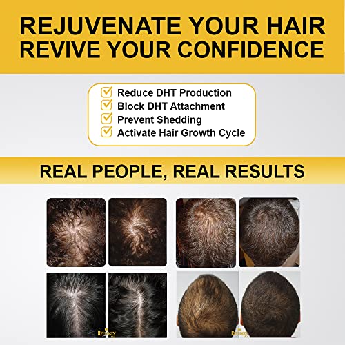 Revivogen-MD-Scalp-Therapy-Thinning-Hair-Solution-Shampoo-Conditioner-Set