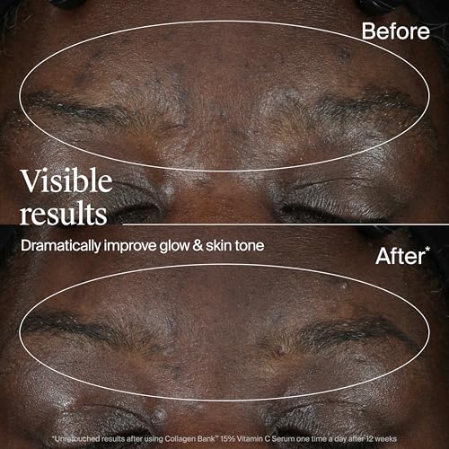Neutrogena Collagen Bank 15% Vitamin C Face Serum, Vitamin C Serum for Face Helps Build Collagen for Glowing, Plumper Looking Skin, Uneven Skin Tone Treatment, Fragrance Free, 0.5 fl. oz - Image 6