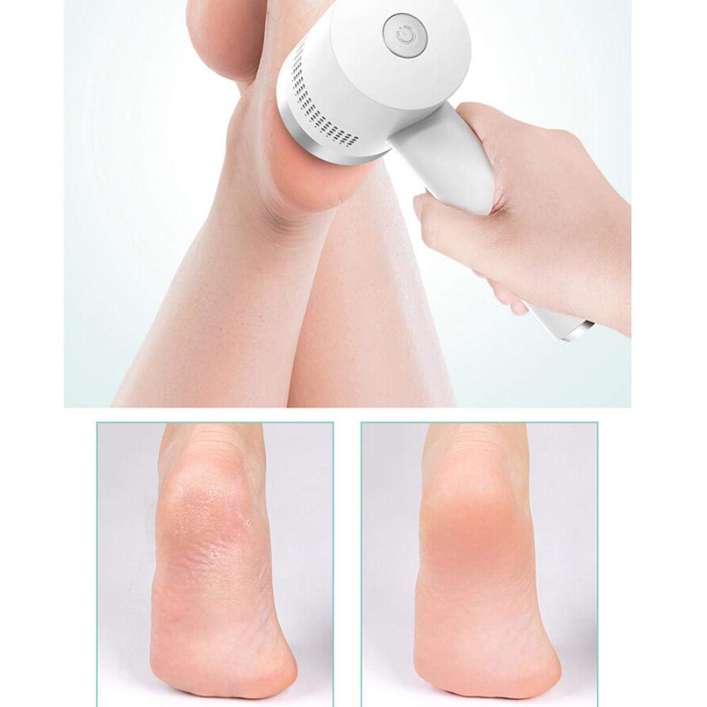 Rimozione callosa elettrica, raspa callosa Raspa callosa Cura dei piedi Set pedicure per la cura dei piedi con 3 teste di levigatura e di aspirapolvere e 2 livelli di velocità