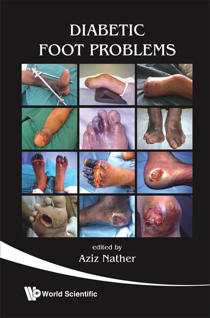 DIABETIC FOOT PROBLEMS