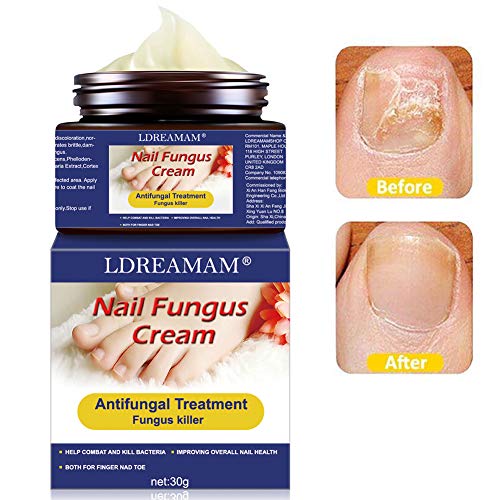 Top 15 BEST Nail Treatment For Damaged Nails 2019 Tacky Living