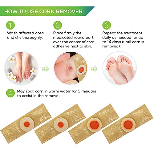 Samsali Corn Remover, Corn Feet Remover, 42 Corn Remover, Corn Removers for Feet and Toe, Toe Corn and Callus Removal, Best Corn Remover for Foot Corn Removal, 42 Pack