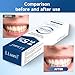 Lisani Set 2-Pack Hydroxyapatite Toothpaste for Teeth Remineralization, Enamel Repair, Sensitivity Relief & Whitening Fluoride-Free, Deep Cleaning Care, Fresh Breath