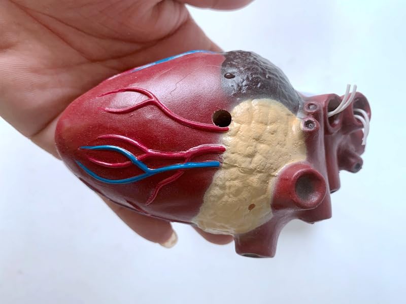 Medical Science Dog Heart Pathology Model Canine Heart Dog Heartworm Anatomical Model
