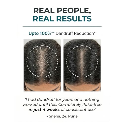 Image of Ravel PRO Anti-Dandruff Shampoo (150ml) + Anti-Dandruff Conditioner (150ml) + Anti-Dandruff Lotion (50ml) | Helps reduces Itchiness & Prevents Dandruff | Paraben-Free, Color-Safe | For Men & Women | Suitable for all Hair Types
