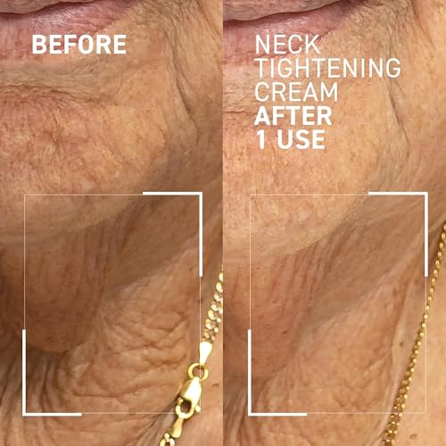 Dr. Brandt Skincare 100000000798 Dr. Brandt Needles No More Neck Tightening Cream thumb #2