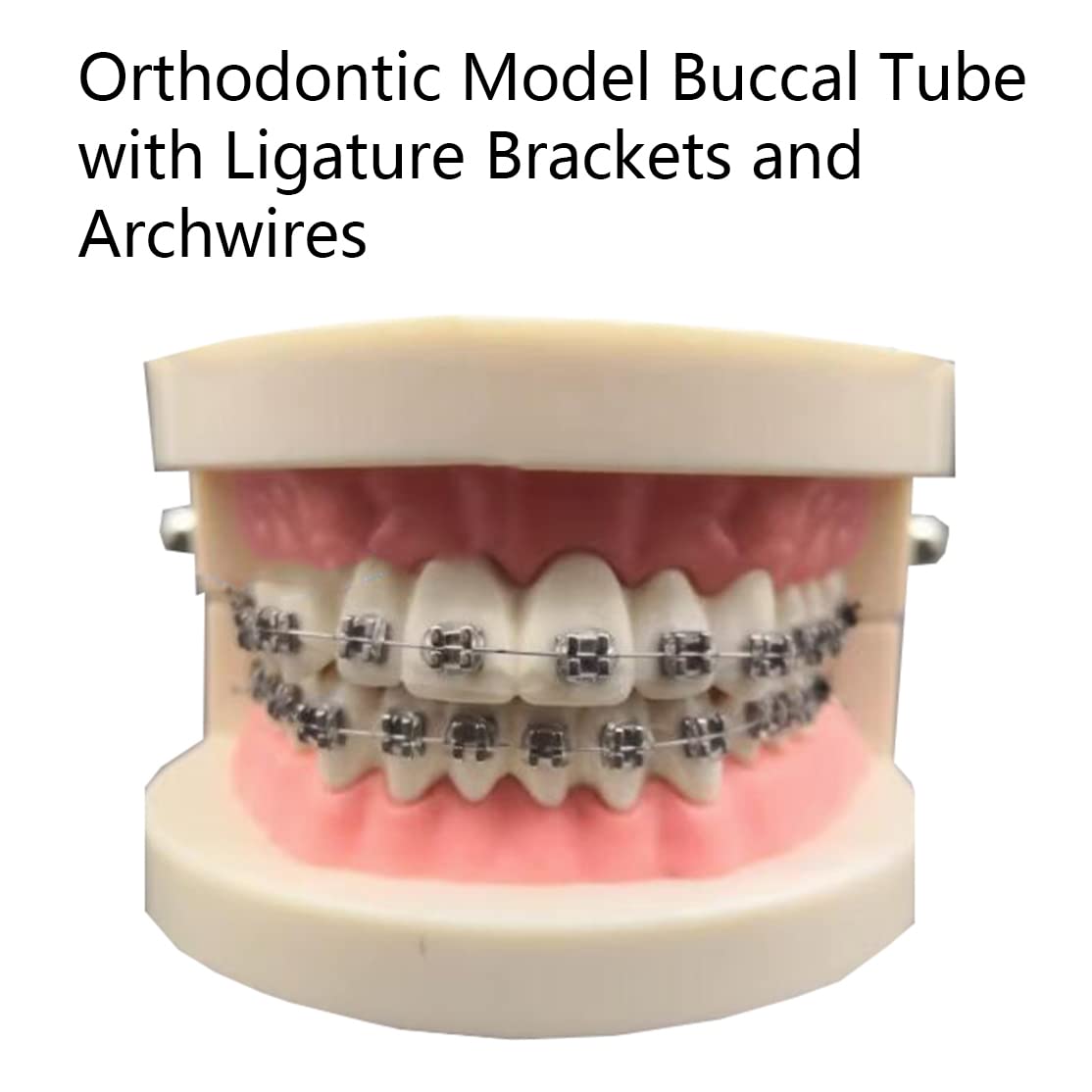 Modello di Simulazione dei Denti orali - Modello dimostrativo ortodontico Dentale - Modello di Trattamento dei Denti dentali con Attacco Metallico, Modello esplicativo dell'ar,B