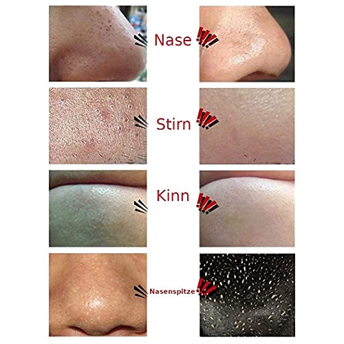 Das ORIGINAL - SOENA® Black Mask + MASKENPINSEL | XXL Tube 100 ml | Entfernt Mitesser – Peel-Off Maske - Gegen unreine… - Image 3