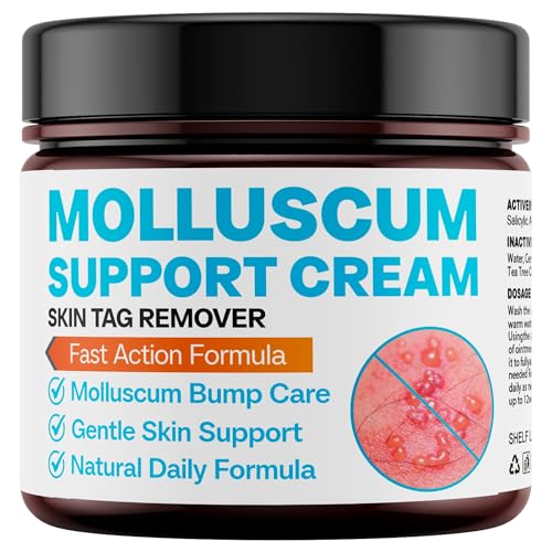 SHUNNIUB Molluscum Support Treatment Molluscum Support Cream All Natural Support Cream for Molluscum Rash