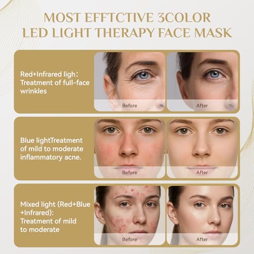 Image of Red Light Therapy for Face Mask,led Red & INR light Treatment Wrinkles Acne | Skin Care Mask & Neck,Red /Blue /Infrared light Therapy Wavelength for Home Use, Working Travel Yoga Sleep, 10 /20 /30 Min Timer
