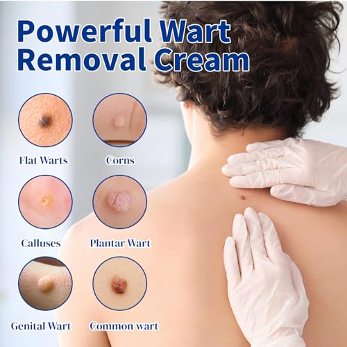 Image of Bighero 2 Pack Wart Fast Acting Gel Wart Remover Freeze Off Ointment,Wartes Cream for Genital Wartss, Warts, Plantar Warts, Common Wartes, Corn, Flat Wars NDC (84010-047-02)
