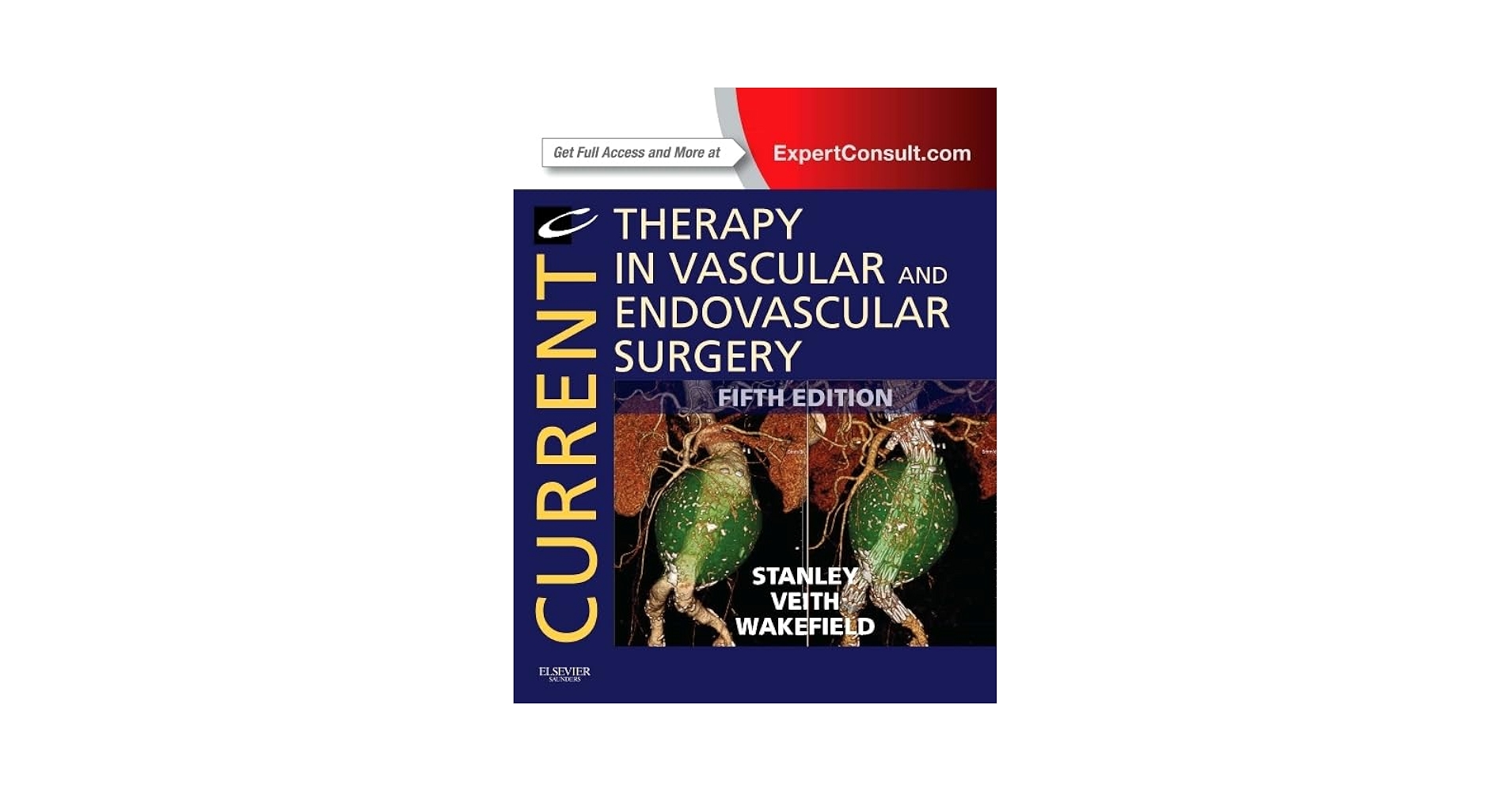 Current Therapy in Vascular and Endovascular Surgery