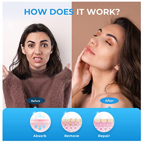 Sumifun Eczema Cream, Psoriasis Cream, Eczema Treatment for Seborrheic Dermatitis, Jock Itch, Shingles, Rosacea, Rashes Treatment, Eczema Relief Dry, Itching, Anti-Itch Cream(7.05oz)